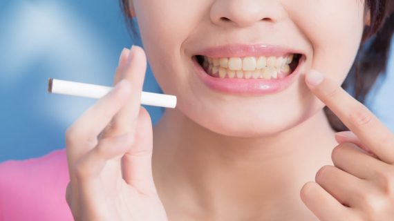 اثرات سیگار بر دندان چیست؟